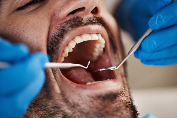 Best Emergency Treatment for Dental Infections or Abscesses in West Crossett, AR
